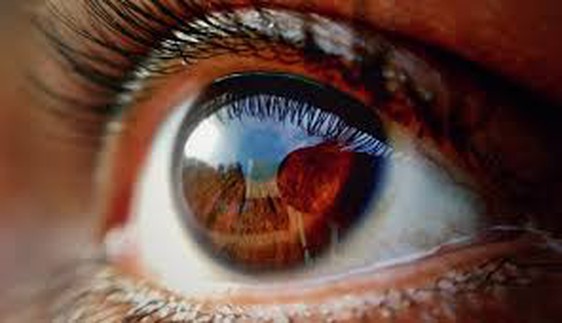 Cidofovir treats Cytomegalovirus CMV retinitis Cidofovir treats Cytomegalovirus CMV retinitis